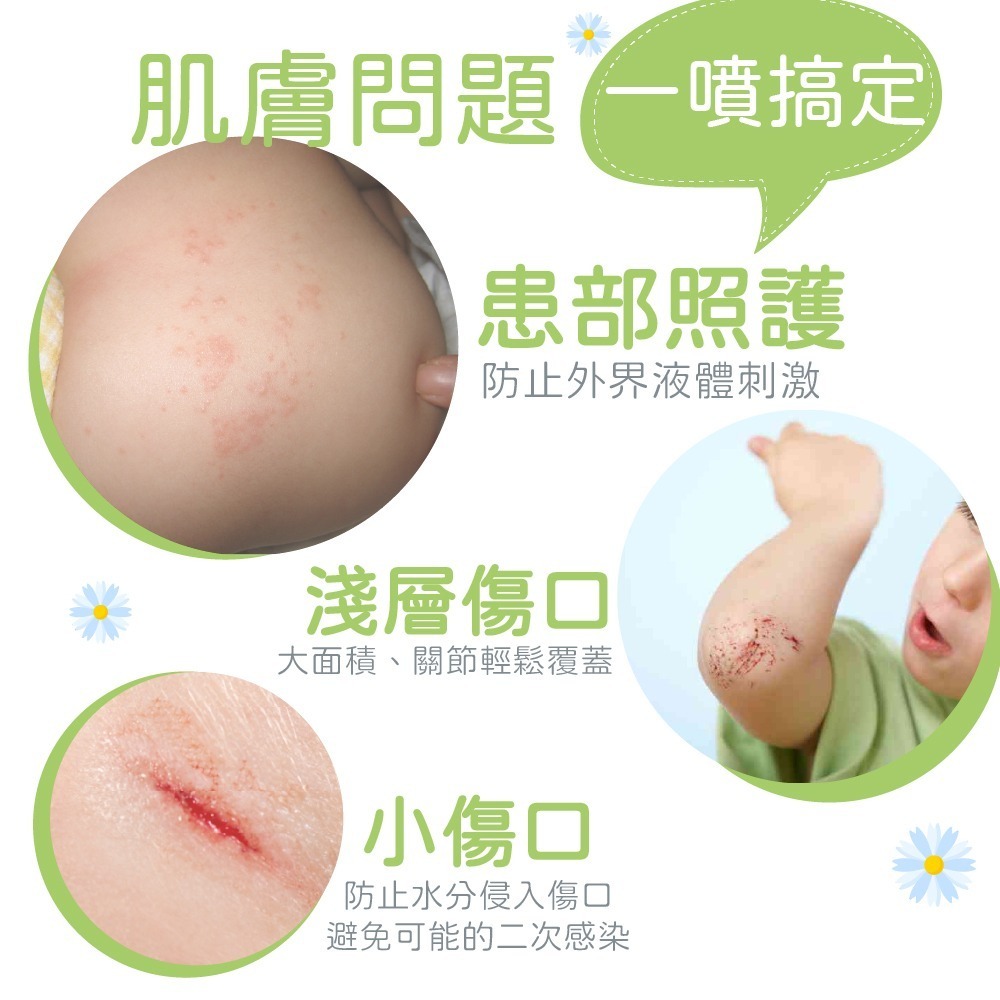 DOHO「寶貝噴」75ml | 紅屁屁對策 | 不刺痛的液態繃帶 | 噴的OK蹦-細節圖5