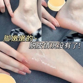沃霸💞卡貝娜皴裂膏20g保溼滋潤防乾裂防凍手足霜舒潤護腳跟皴裂膏-細節圖5