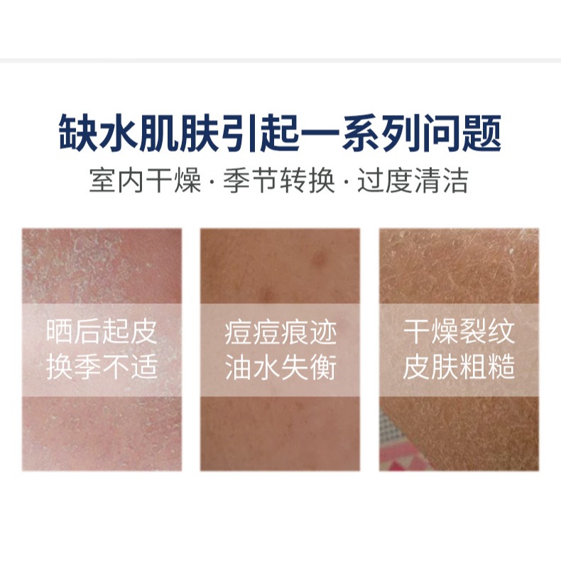 沃霸💞維生素原B5保濕霜 身體乳 護手霜 補水 滋潤 面霜 補水保濕身體乳 改善粗糙 乾裂 滋潤面-細節圖6