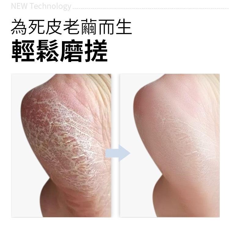 【同闆購物】不銹鋼腳皮刨刀 去腳皮器 去死皮器 去厚繭 不鏽鋼刮腳皮刀 腳皮刮刀 刮腳皮 分離式刀頭 刮腳器 修腳器-細節圖3