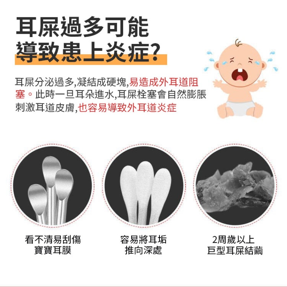 挖耳神器 兒童挖耳棒 掏耳朵 挖耳器 耳勺 掏耳朵 耳屎夾 掏耳 耳屎鑷子 耳勺 耳屎夾 掏耳 超值兩件組 發光挖耳器-細節圖2