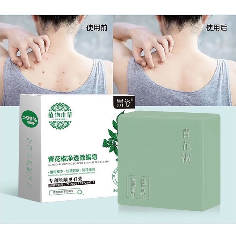 🔥買5送1🔥青花椒除螨皂 除螨皂 青花椒香皂 控油消蟎洗臉皂 去螨皂 沐浴皂 香皂 肥皂 青花椒除螨 洗臉皂 除螨祛-細節圖6