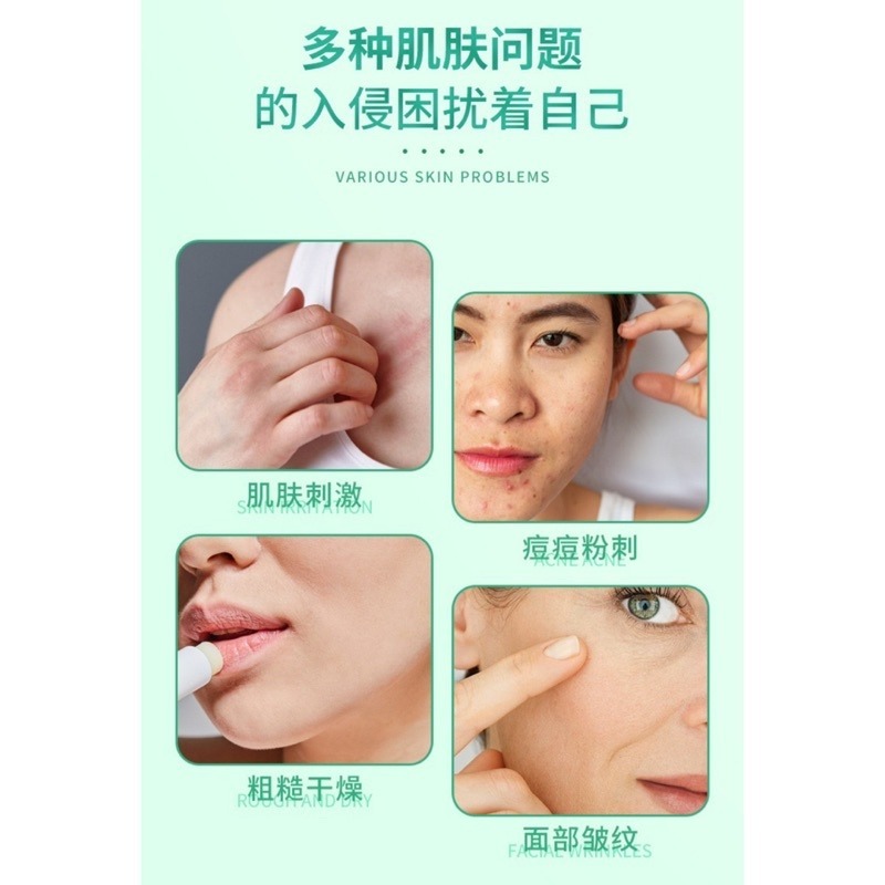 🔥買5送1🔥蘆薈皂 天然蘆薈皂 蘆薈顆粒精華皂 蘆薈精油皂 保濕蘆薈皂 修護保濕皂 補水保濕 沐浴皂 潔面皂 香皂-細節圖3