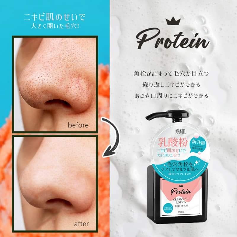 淨美肌 益生元粉刺排汙導出洗面乳（升級版）  罐-細節圖6