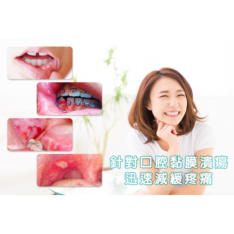 【台丞藥局】速口舒 口內凝膠 15 ml 保護嘴破傷口 速口樂 嘴破-細節圖5