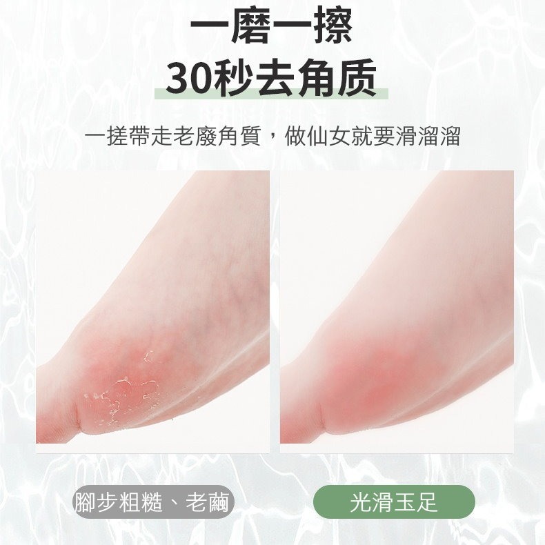 【🦶美足神器】電動磨腳器✨吸塵式去腳皮神器｜USB充電｜二段磨頭｜足部護理機｜去腳皮死皮機-細節圖9