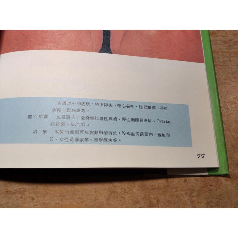 (民國73年)彩色圖說皮膚病：1+2│劉接寶 譯│立得│老書-細節圖6