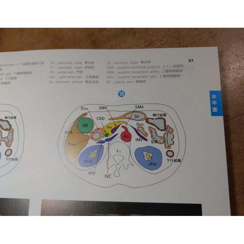 日文3D anatomy腹部エコー・CTを立体的に読む新裝版│加藤高明│日本醫事新報社9784784941865│七成新-細節圖5