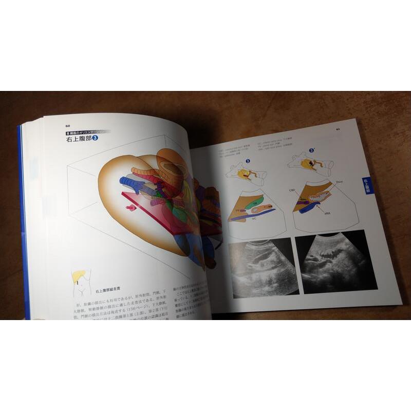 日文3D anatomy腹部エコー・CTを立体的に読む新裝版│加藤高明│日本醫事新報社9784784941865│七成新-細節圖6