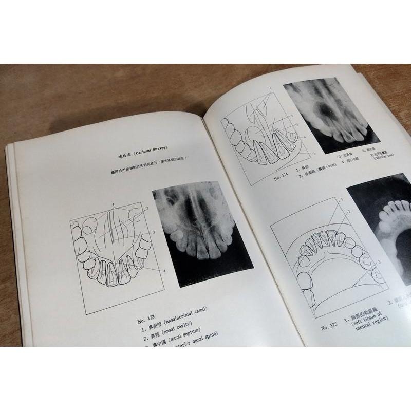 民國65年初版：牙科放射線診斷圖譜│菊地厚│合記│翁秀和、高資彬、石怡昌│老書-細節圖4