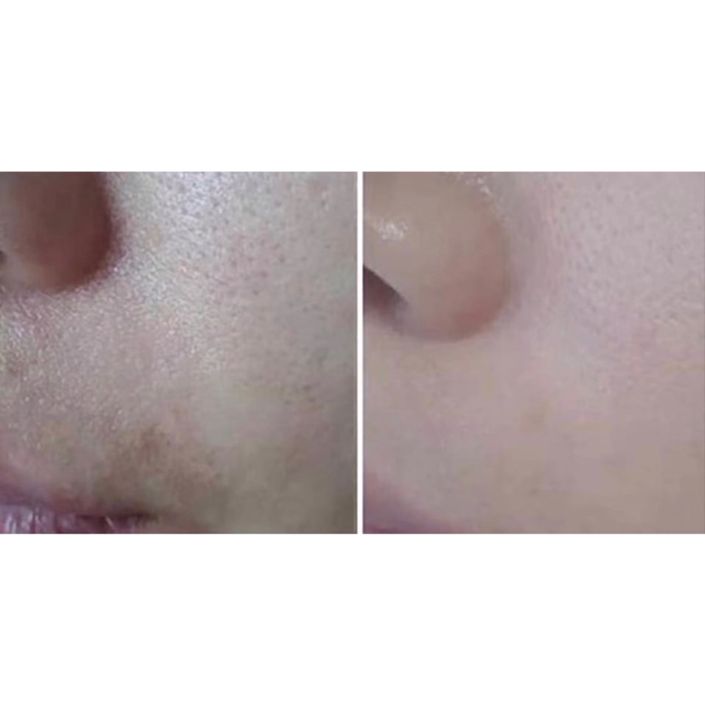 現貨寄出不用等 🇰🇷韓國SUNGBOON EDITOR 綠番茄緊緻毛孔安瓶 精華 加大容量 安瓶 毛孔精華-細節圖5