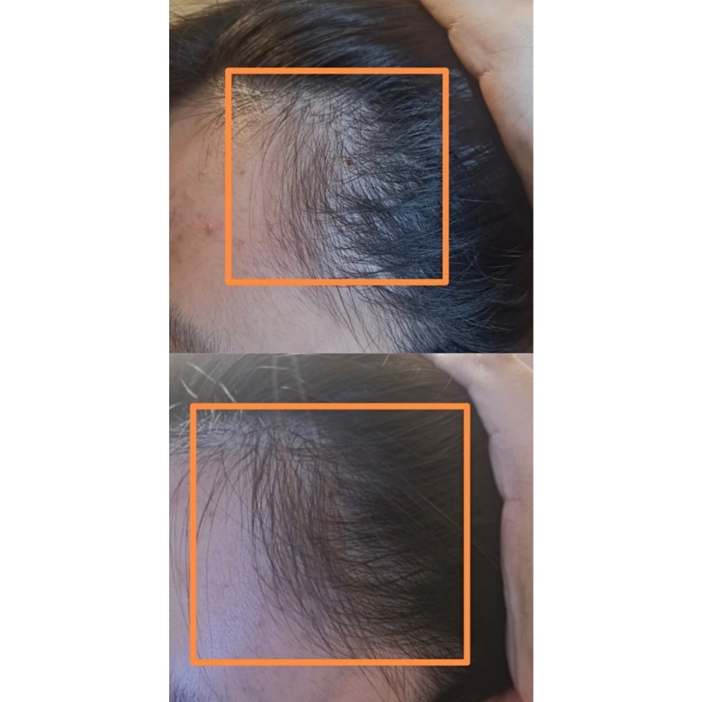 預購2-3週 GROW GORGEOUS  強效增髮精華60ml 頭皮精華 頭髮精華-細節圖4