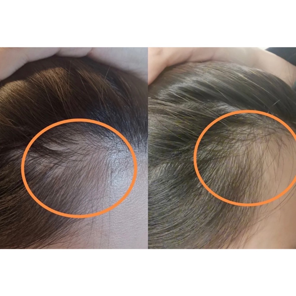 預購2-3週 GROW GORGEOUS  強效增髮精華60ml 頭皮精華 頭髮精華-細節圖5