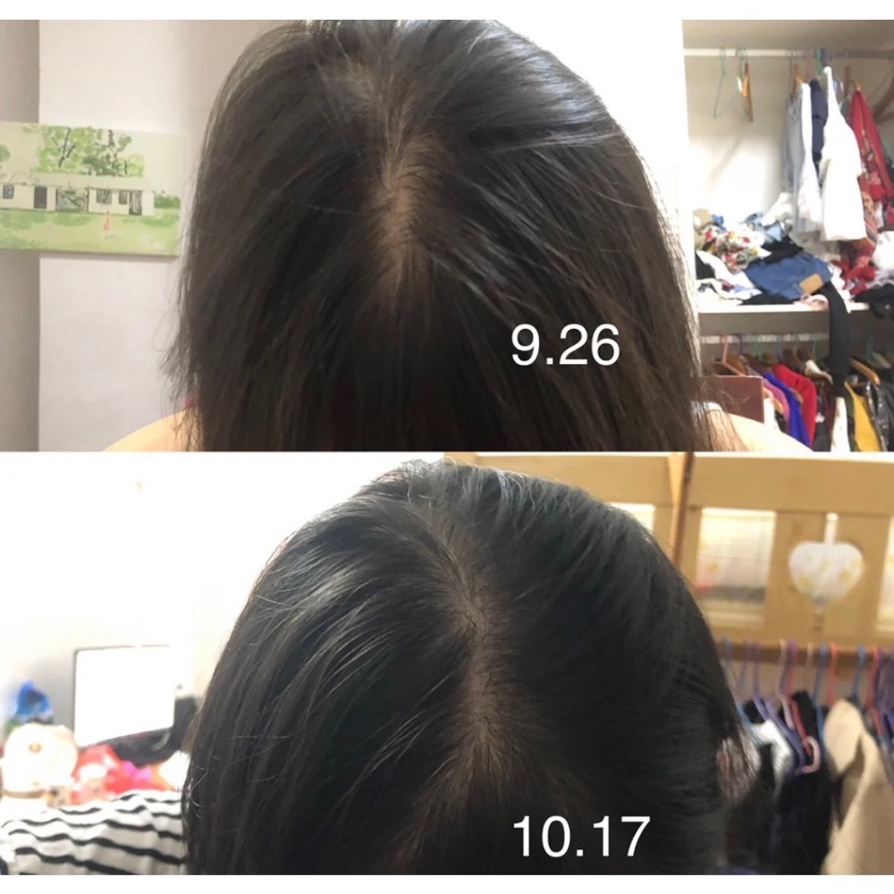 預購2-3週 GROW GORGEOUS  強效增髮精華60ml 頭皮精華 頭髮精華-細節圖6