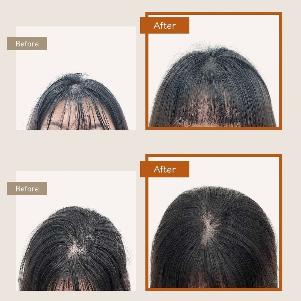 現貨│THE VITA 乾洗髮蓬鬆噴霧 the vita乾洗髮 乾洗髮噴霧-細節圖4