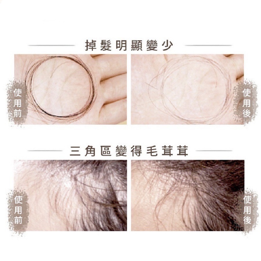 現貨免運│THE VITA 頭皮調理液 the vita頭皮水 薰衣草頭皮水-細節圖3