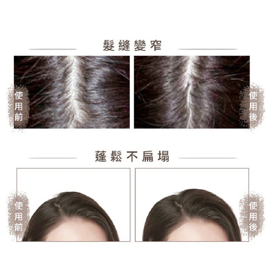 現貨免運│THE VITA 頭皮調理液 the vita頭皮水 薰衣草頭皮水-細節圖4