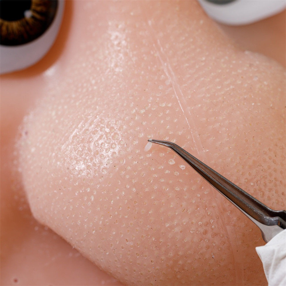 超紓壓擠痘痘玩具 擠黑頭粉刺 爆漿痘 可更換粉刺 草莓鼻 黑頭粉刺-細節圖3