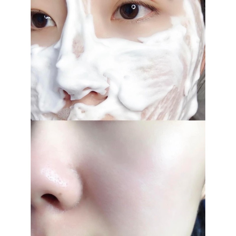 🔥現貨供應中🔥 日本SUMERISH 碳酸活氧回春面膜150g-細節圖6