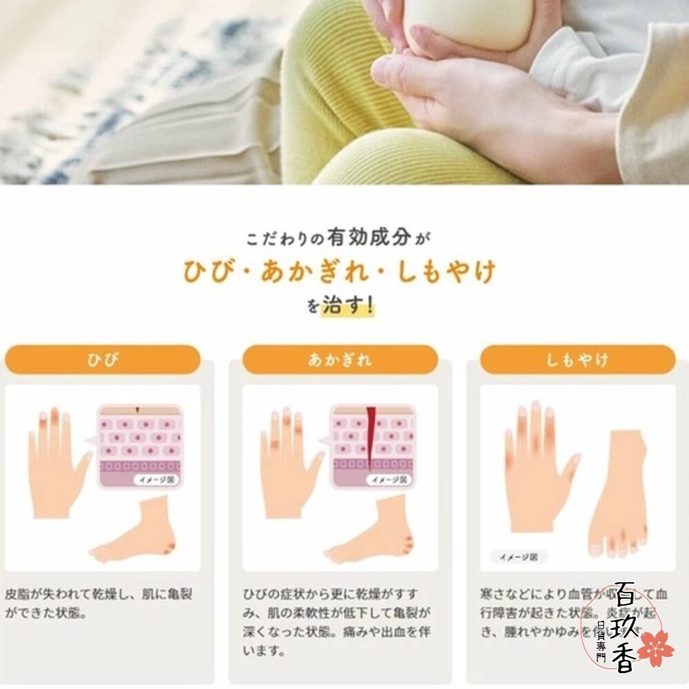 即期買一送一 日本境內 原裝進口 Yuskin 悠斯晶 乳霜 護膚霜 護手霜 按壓瓶 40g 80g 護足 乾燥-細節圖4