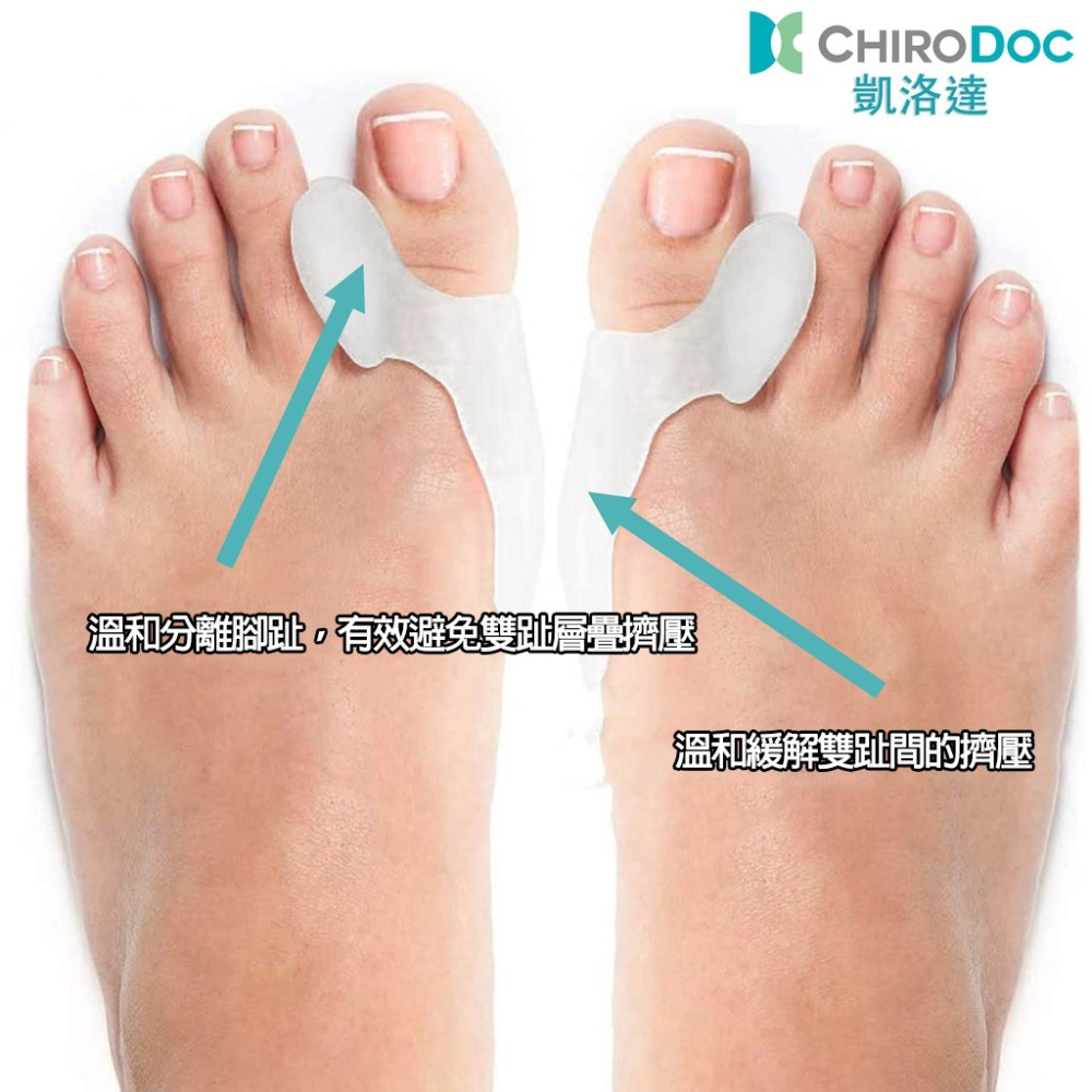 【原廠正品】ChiroDoc美腿分趾套（一雙）- 拇指套 腳趾紓壓 柔軟矽膠指環 五指分隔 日常足部保養 高跟鞋救星-細節圖5