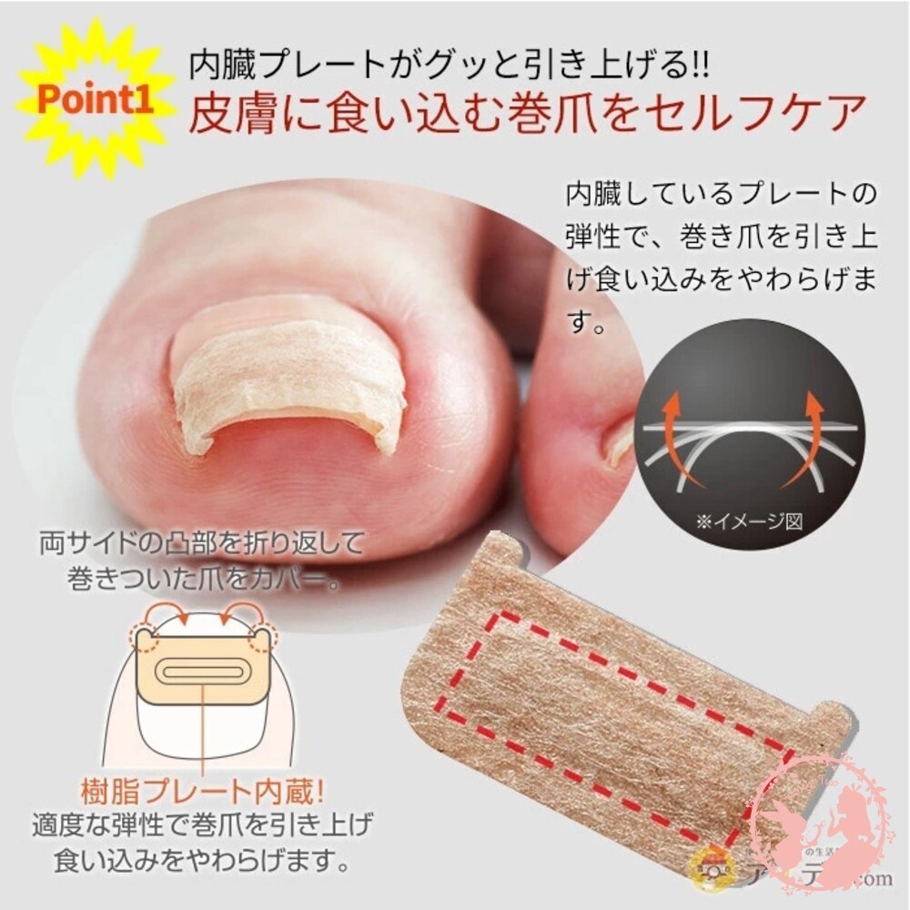 日本製 凍甲貼片 【COGIT】卷爪Dr.pro凍甲 甲溝炎 矯正貼片 指甲保護貼片 (80入)-細節圖4