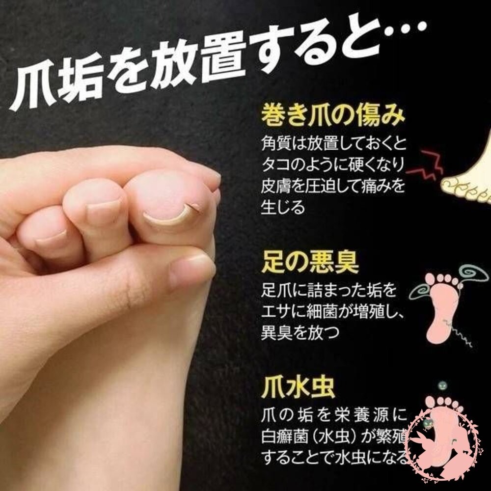 日本製 GREENBELL  不銹鋼 腳指甲縫隙清潔除垢棒 甲溝 甲垢 美甲  足部☆火速出貨  發票-細節圖2