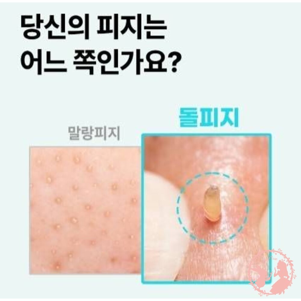 韓國新品 ilso溫和舒緩粉刺導出液-細節圖4