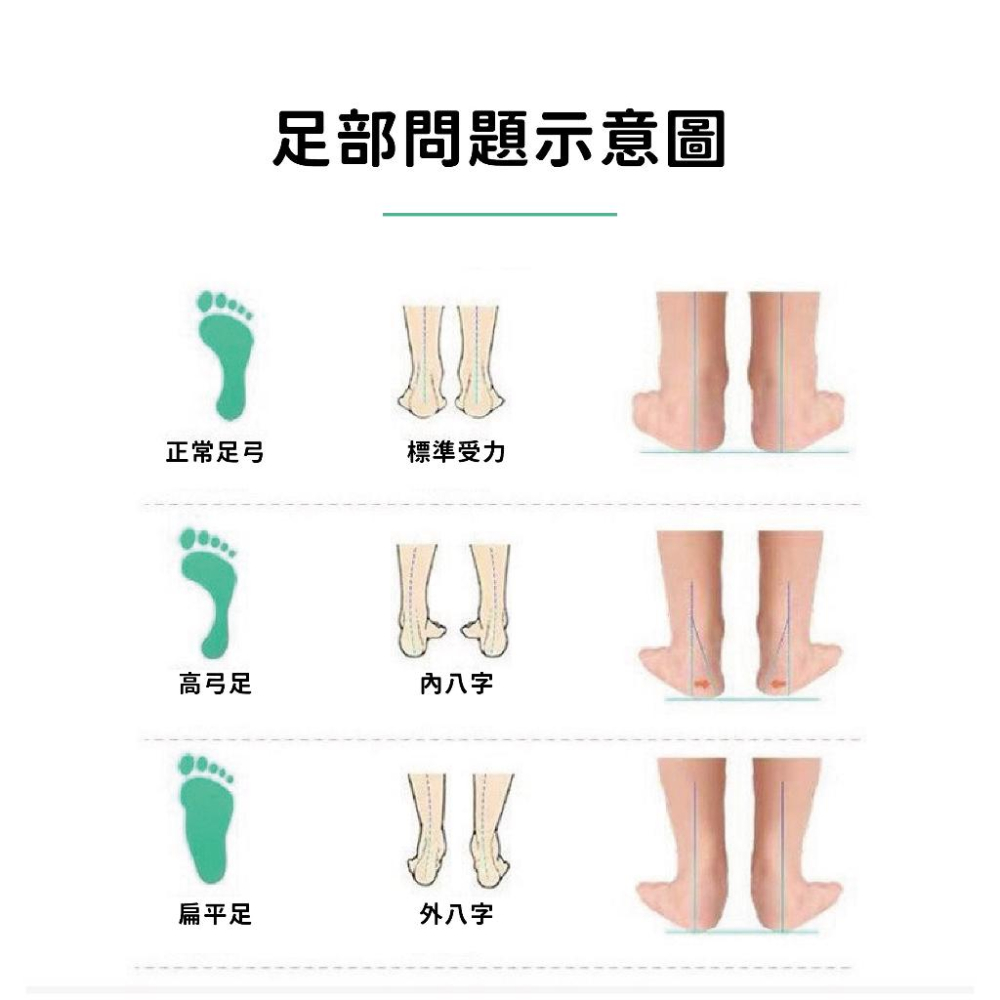 【現貨】日本熱銷! 足底矯正器 足弓鞋墊 足弓墊 足底支撐 偏足矯正 足外翻矯正器 高足弓 XO型腿 足弓支撐 腿型矯正-細節圖3
