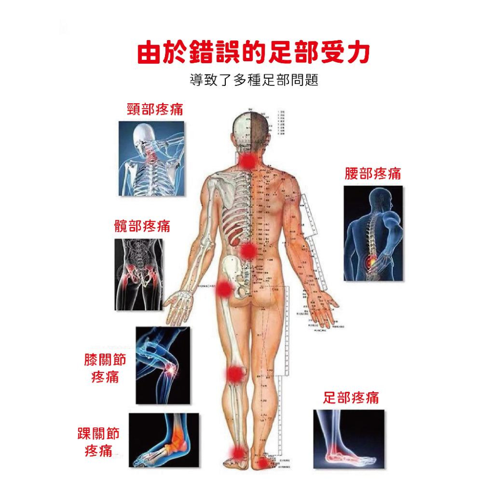 【現貨】日本熱銷! 足底矯正器 足弓鞋墊 足弓墊 足底支撐 偏足矯正 足外翻矯正器 高足弓 XO型腿 足弓支撐 腿型矯正-細節圖4