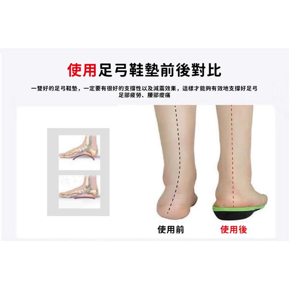 【現貨】日本熱銷! 足底矯正器 足弓鞋墊 足弓墊 足底支撐 偏足矯正 足外翻矯正器 高足弓 XO型腿 足弓支撐 腿型矯正-細節圖7