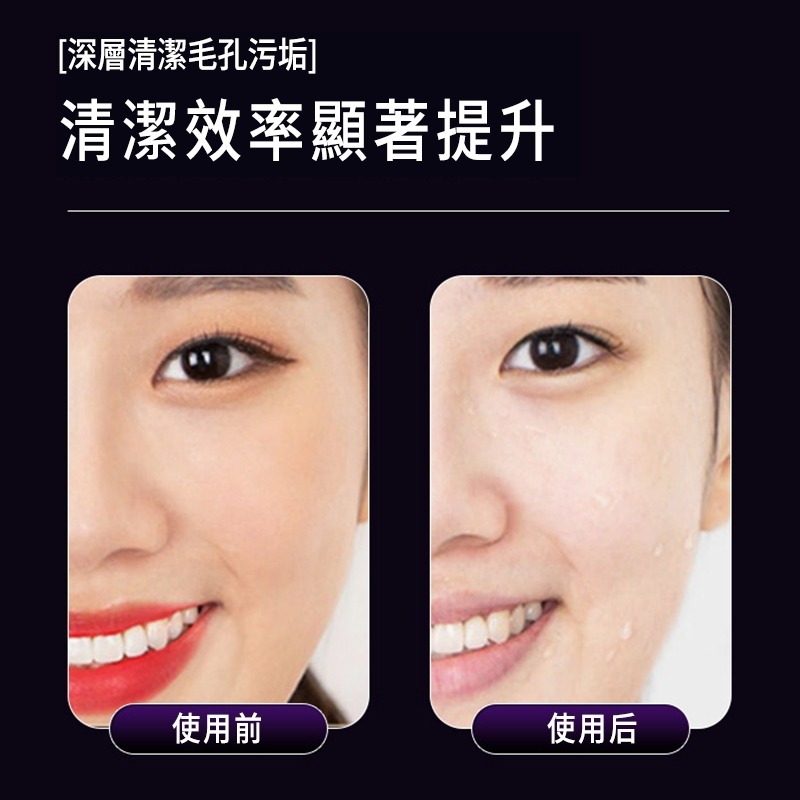 美容儀 導入儀 潔面儀 臉部美容儀 提拉緊緻肌膚 淡紋去紋神器 提拉潔面按摩儀 冷暖震動美容 電動美頸儀 臉部清潔-細節圖5