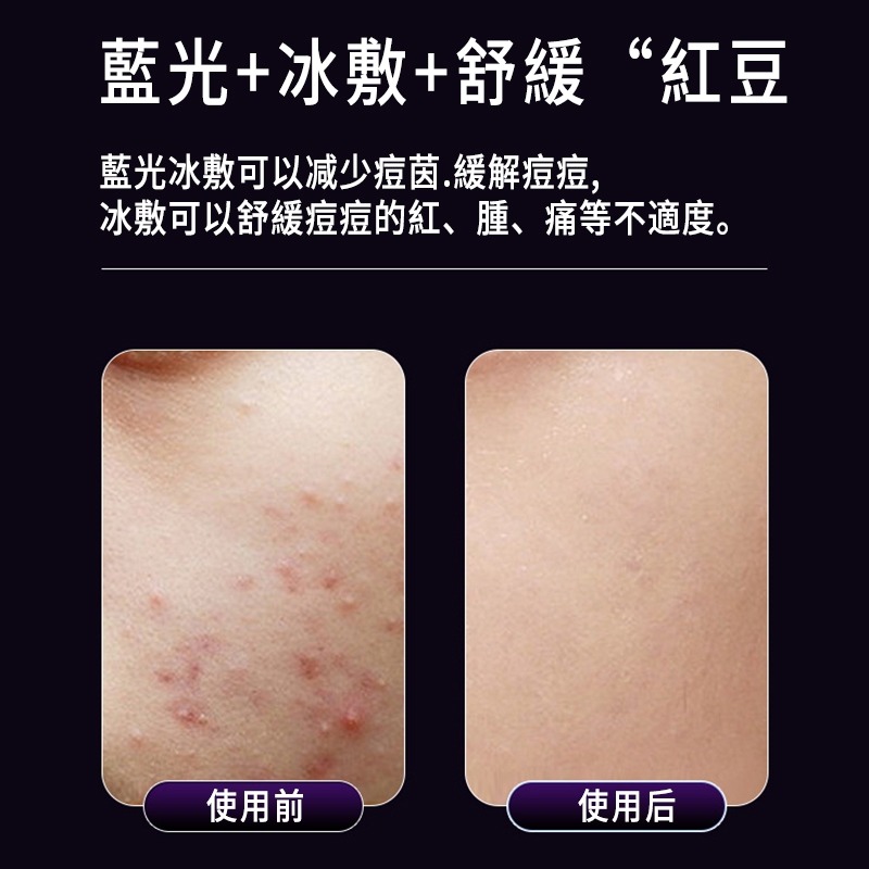 美容儀 導入儀 潔面儀 臉部美容儀 提拉緊緻肌膚 淡紋去紋神器 提拉潔面按摩儀 冷暖震動美容 電動美頸儀 臉部清潔-細節圖6