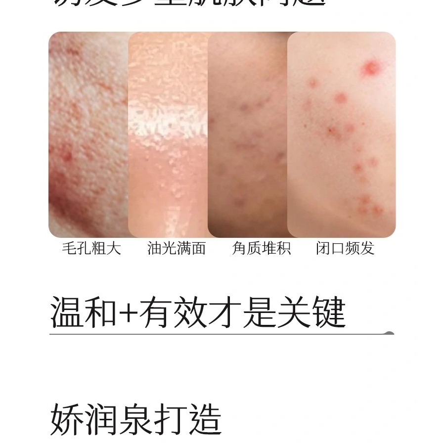 ♛ROSEMAYR♛廠商寄賣-嬌潤泉 甄顏淨透清潔泥膜-細節圖4