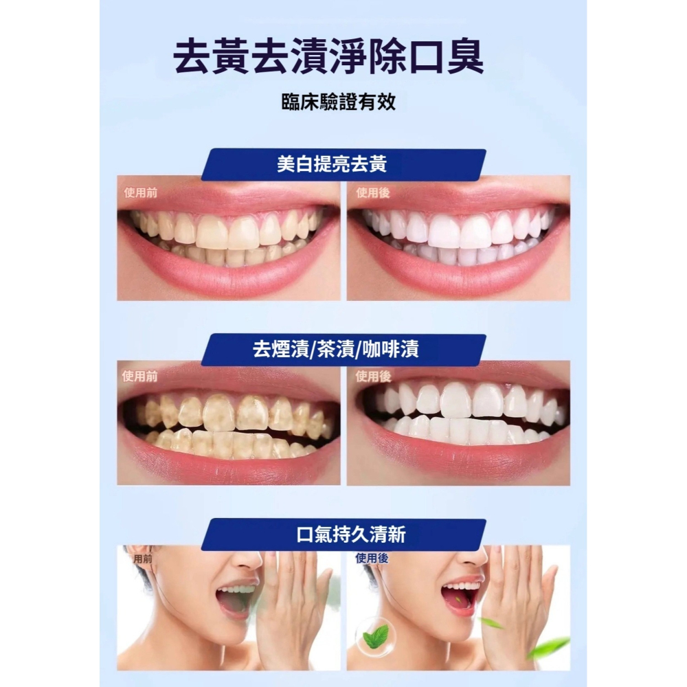 ♛ROSEMAYR♛廠商寄賣-Dr.Roelof 光學色修牙齒淨白精華-細節圖4