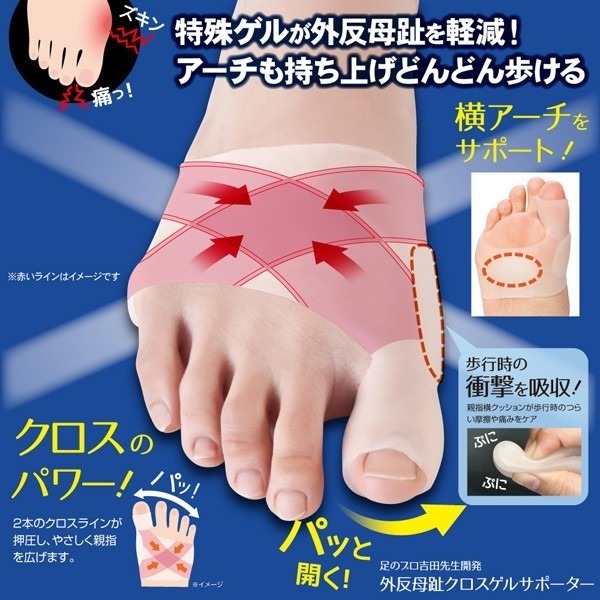 ✨拇指外翻保護套✨現貨 日本Alphax 拇指外翻襪 腳踝護具 足弓支撐 分趾襪 拇指外翻 矯正襪 機能襪-規格圖8