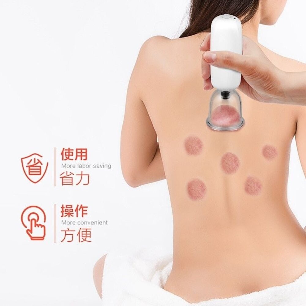 【台北士林*店面】電動拔罐刮痧儀 拔罐儀器 拔罐器 疏通經絡 美容除濕氣神器 鑑賞期 送禮-細節圖3