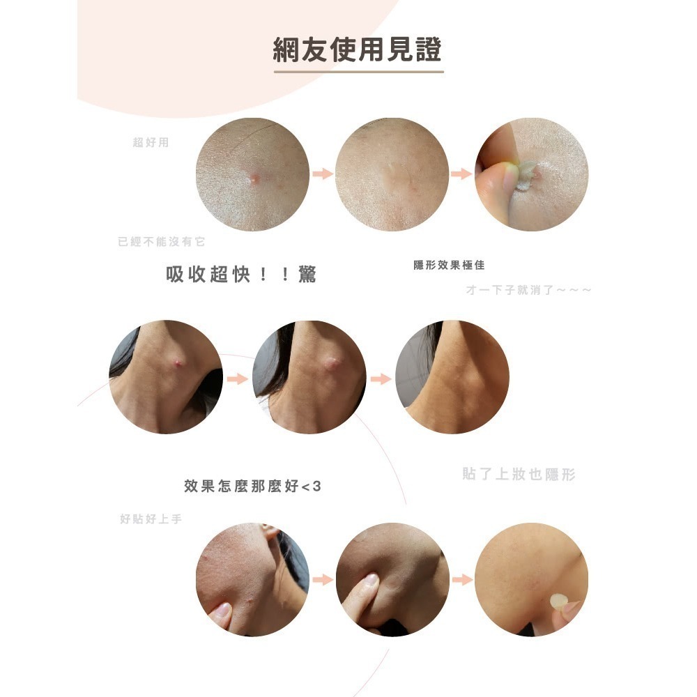【優若美】痘痘貼 - 薄型1.2cm (30入/盒 )-細節圖7