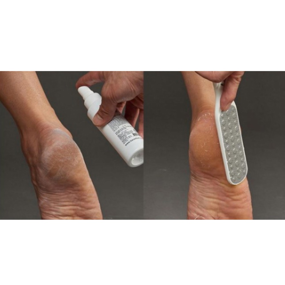 現貨 韓國代購 baren 腳後跟修護組 Set, 足部軟化劑 100毫升 1入 + 腳銼 1入, 100ml, 1組-細節圖4