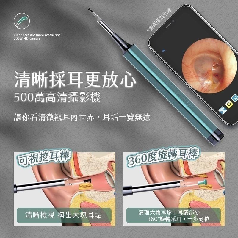【限時購】HF-1 無線高清可視智能挖耳棒 掏耳棒 掏耳 耳棒  挖耳棒 掏耳神器-細節圖9