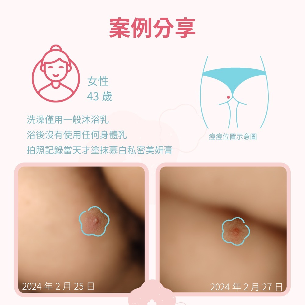 【JJTC】慕白私密美妍膏-細節圖7