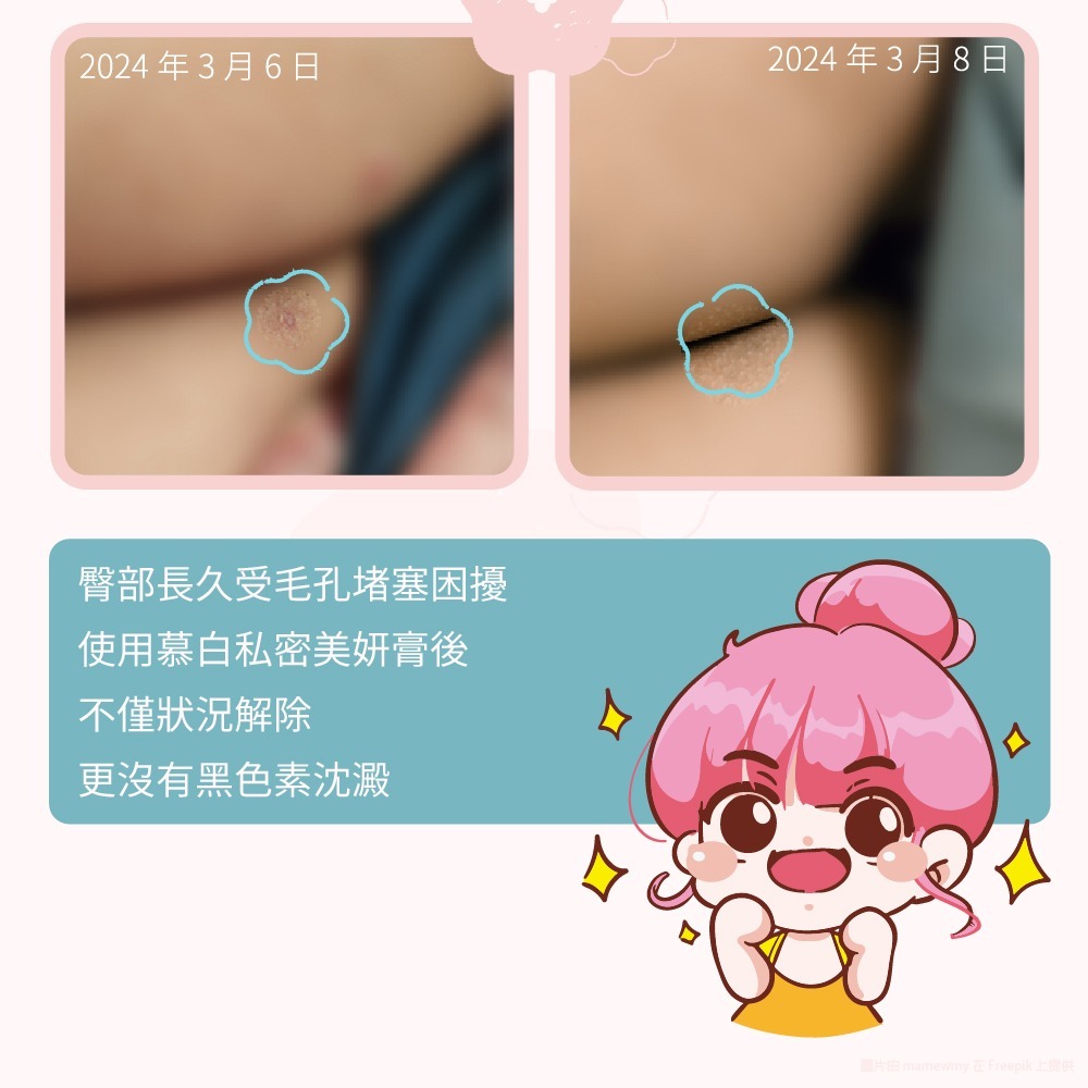 【JJTC】慕白私密美妍膏-細節圖8