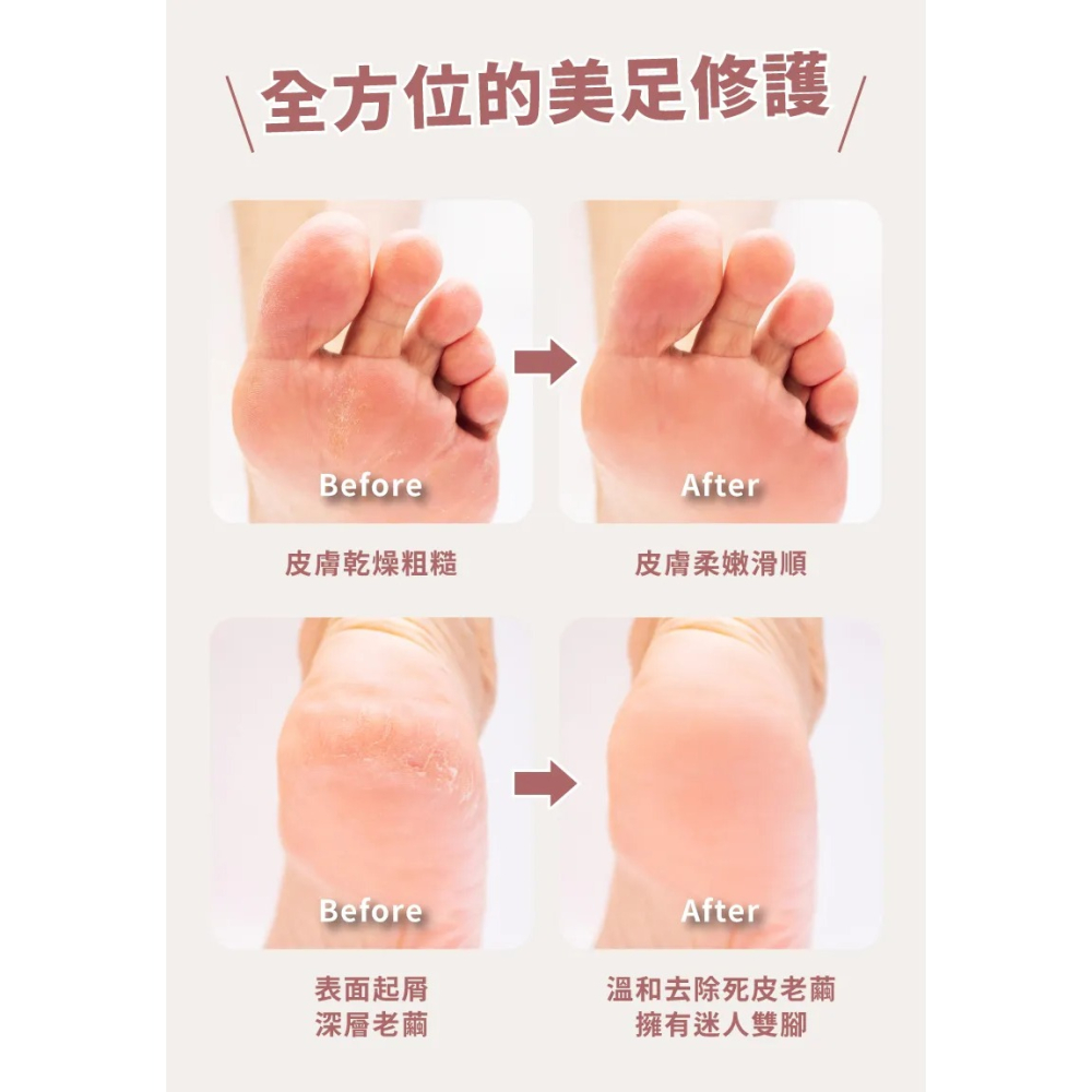 【MUNICHI 沐尼黑】臭氧滅菌美足修磨儀/電動磨腳皮機/自動磨腳皮/去腳皮機(MR.FEET)-細節圖2