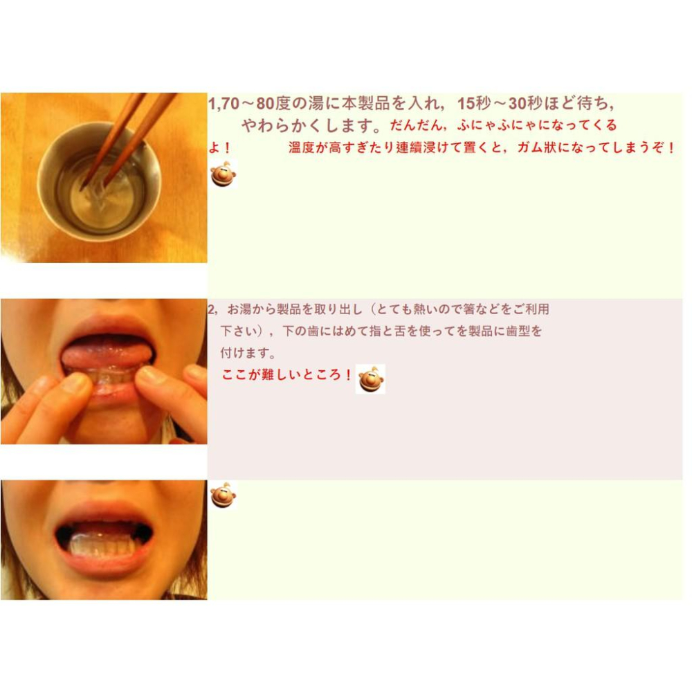 【博斯音樂】日本Nonaka Liprotect 薩克斯風/單簧管牙齒保護墊/下牙膠可塑型護齒墊(日本製)-細節圖3
