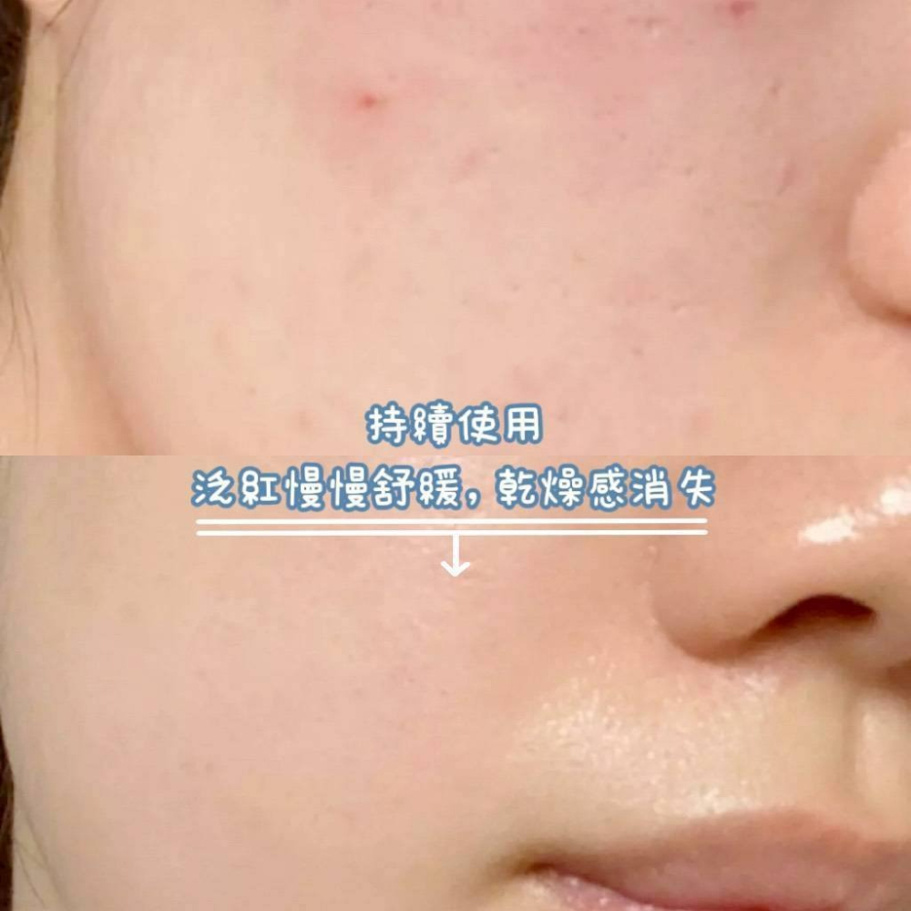 0405-韓國商品 🇰🇷 MEDITHERAPY 藍色積雪草修護乖乖霜 100ml-細節圖3