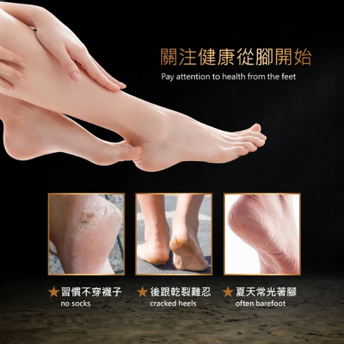 【ME5】C008 微米腳皮銼 (藍色/黑色/粉色)-細節圖6