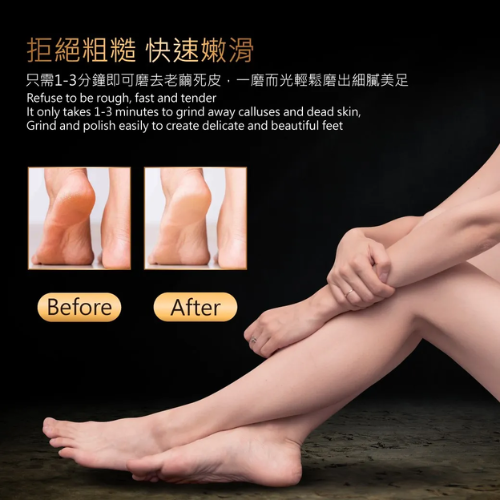 【ME5】C008 微米腳皮銼 (藍色/黑色/粉色)-細節圖7