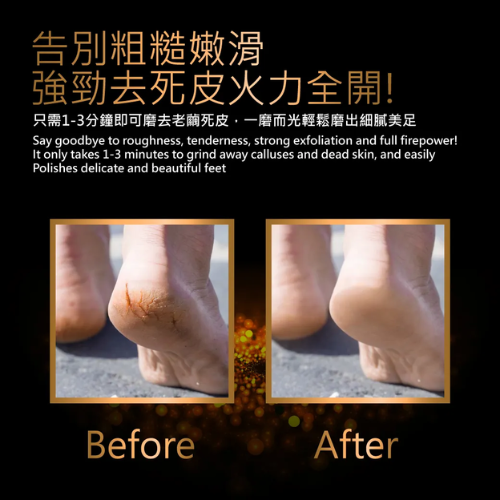 【ME5】C012 水滴微米腳皮銼-細節圖7