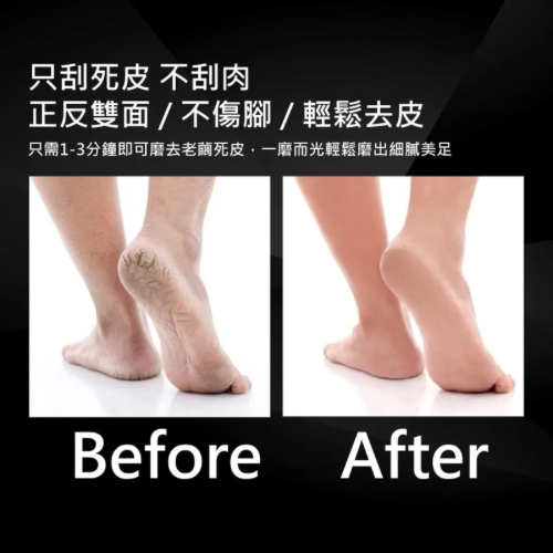 【ME5】C070 極品雙面腳皮銼-細節圖5