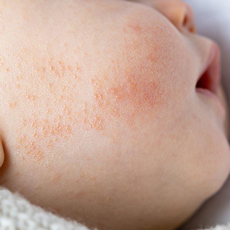 【海洋之膚】嬰兒海洋舒敏營養霜 (蘋果臉適用)100mL 法國進口 鎮安中西安和藥局-細節圖5